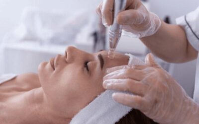 What Is Microneedling With Bio-Enhancement And What Are Its Benefits?
